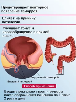 Свечи от геморроя китайские, мускусные