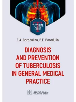 Diagnosis and prevention of tuberculosis in general medical